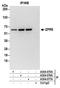 Zinc Finger Protein 622 antibody, A304-075A, Bethyl Labs, Immunoprecipitation image 