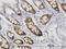 Cyclin Dependent Kinase 1 antibody, H00000983-M01, Novus Biologicals, Immunohistochemistry paraffin image 