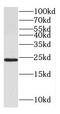 Growth Hormone 2 antibody, FNab03448, FineTest, Western Blot image 