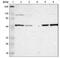 Lectin, Mannose Binding 1 antibody, NBP1-84812, Novus Biologicals, Western Blot image 