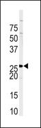 Sprouty RTK Signaling Antagonist 4 antibody, PA5-14349, Invitrogen Antibodies, Western Blot image 