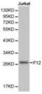 Coagulation Factor XII antibody, TA327143, Origene, Western Blot image 