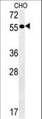 Amylase Alpha 2A (Pancreatic) antibody, LS-B11116, Lifespan Biosciences, Western Blot image 