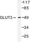 Solute Carrier Family 2 Member 3 antibody, LS-C176045, Lifespan Biosciences, Western Blot image 