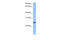 Rhophilin Associated Tail Protein 1B antibody, 30-769, ProSci, Enzyme Linked Immunosorbent Assay image 