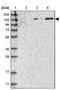 SPOC Domain Containing 1 antibody, PA5-56827, Invitrogen Antibodies, Western Blot image 