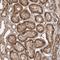 ETAA1 Activator Of ATR Kinase antibody, HPA035048, Atlas Antibodies, Immunohistochemistry paraffin image 