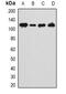 Ankyrin Repeat Domain 28 antibody, abx225033, Abbexa, Western Blot image 