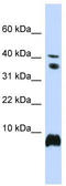 High Mobility Group Nucleosome Binding Domain 1 antibody, TA330633, Origene, Western Blot image 