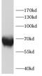 Follicle Stimulating Hormone Receptor antibody, FNab10451, FineTest, Western Blot image 