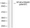 Nuclear Factor Kappa B Subunit 1 antibody, LS-C117428, Lifespan Biosciences, Western Blot image 