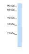 Myeloid Leukemia Factor 2 antibody, orb325281, Biorbyt, Western Blot image 