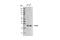 Peroxiredoxin 6 antibody, 95336S, Cell Signaling Technology, Western Blot image 