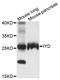 Iodotyrosine Deiodinase antibody, STJ111610, St John