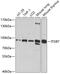 Integrin Subunit Beta 7 antibody, GTX66467, GeneTex, Western Blot image 