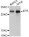 Sepiapterin Reductase antibody, abx126633, Abbexa, Western Blot image 