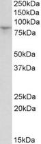 Hyperpolarization Activated Cyclic Nucleotide Gated Potassium Channel 3 antibody, NBP1-68869, Novus Biologicals, Western Blot image 