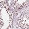General Transcription Factor IIF Subunit 1 antibody, HPA070752, Atlas Antibodies, Immunohistochemistry paraffin image 