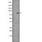 Hepatocyte Growth Factor-Regulated Tyrosine Kinase Substrate antibody, abx146976, Abbexa, Western Blot image 