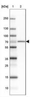 Glucose 1,6-bisphosphate synthase antibody, NBP2-31656, Novus Biologicals, Western Blot image 