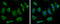 Hydroxyacyl-CoA Dehydrogenase antibody, GTX105167, GeneTex, Immunofluorescence image 