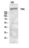 Tenascin C antibody, STJ97243, St John