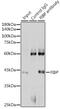 Acidic fibroblast growth factor intracellular-binding protein antibody, GTX53989, GeneTex, Immunoprecipitation image 