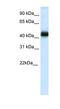 NK2 Homeobox 4 antibody, NBP1-91541, Novus Biologicals, Western Blot image 