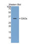 Low-density lipoprotein receptor-related protein 5 antibody, LS-C295191, Lifespan Biosciences, Western Blot image 