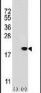 Ubiquitin Conjugating Enzyme E2 V1 antibody, PA5-12044, Invitrogen Antibodies, Western Blot image 