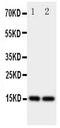 Fatty acid-binding protein, epidermal antibody, PA1853, Boster Biological Technology, Western Blot image 