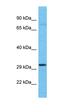 Kelch Repeat And BTB Domain Containing 6 antibody, orb327007, Biorbyt, Western Blot image 