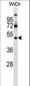 SPT7 Like, STAGA Complex Gamma Subunit antibody, LS-C161622, Lifespan Biosciences, Western Blot image 