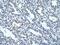 Nuclear Receptor Subfamily 2 Group F Member 2 antibody, PA5-46850, Invitrogen Antibodies, Immunohistochemistry frozen image 