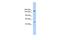 SNF2 Histone Linker PHD RING Helicase antibody, A08323, Boster Biological Technology, Western Blot image 