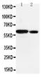 SRC Proto-Oncogene, Non-Receptor Tyrosine Kinase antibody, PA1415, Boster Biological Technology, Western Blot image 