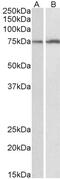 Cytochrome P450 Family 2 Subfamily B Member 6 antibody, abx432570, Abbexa, Western Blot image 
