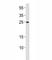 RAB27A, Member RAS Oncogene Family antibody, F47876-0.4ML, NSJ Bioreagents, Western Blot image 