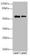 WD Repeat Domain 34 antibody, CSB-PA842668LA01HU, Cusabio, Western Blot image 