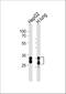 Sulfotransferase Family 1A Member 2 antibody, A03500-1, Boster Biological Technology, Western Blot image 