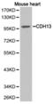 Cadherin 13 antibody, LS-C192728, Lifespan Biosciences, Western Blot image 
