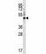 Forkhead Box A1 antibody, F44167-0.4ML, NSJ Bioreagents, Western Blot image 