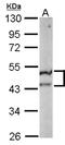 ST3 Beta-Galactoside Alpha-2,3-Sialyltransferase 5 antibody, NBP2-20492, Novus Biologicals, Western Blot image 