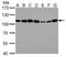 Actinin Alpha 4 antibody, NBP2-15357, Novus Biologicals, Western Blot image 