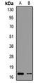 Prefoldin Subunit 2 antibody, LS-C668726, Lifespan Biosciences, Western Blot image 