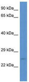 ES Cell Expressed Ras antibody, TA333411, Origene, Western Blot image 
