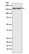 Mitogen-Activated Protein Kinase Kinase Kinase 5 antibody, M00929, Boster Biological Technology, Western Blot image 