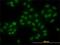 High Mobility Group Box 1 antibody, H00003146-M08, Novus Biologicals, Immunocytochemistry image 