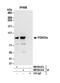 Forkhead Box O3 antibody, NB100-613, Novus Biologicals, Western Blot image 