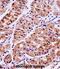 Kallikrein Related Peptidase 15 antibody, abx028332, Abbexa, Immunohistochemistry paraffin image 